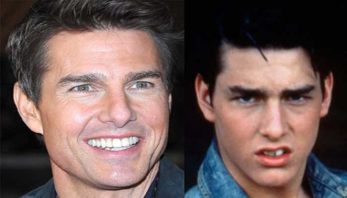 Tom Cruise Teeth Before And After: When Did The Actor Fix His Teeth?