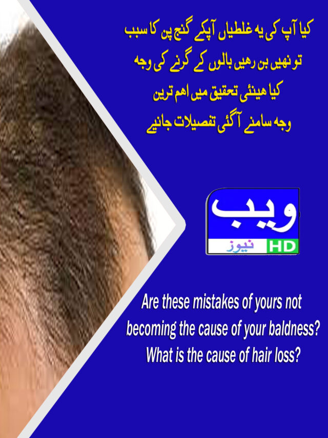 Hair Loss Ki Asal Wajah